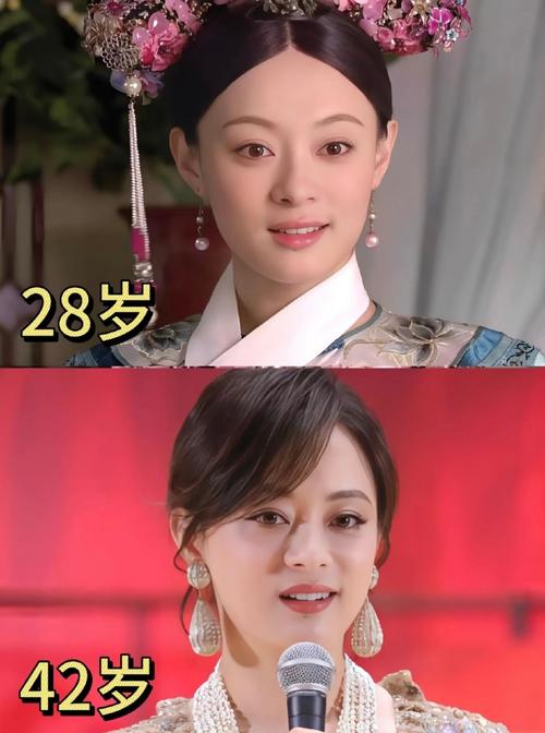 2025新澳门天天开奖免费和孙俪唇下痣没了与孙俪嘴唇的痣